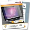 FoliX FX-Anti-Reflex Displayschutzfolie für Apple MacBook Pro