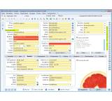 Termin- / Adressverwaltungssoftware im Test: Address Manager 14 von Combit, Testberichte.de-Note: 1.2 Sehr gut
