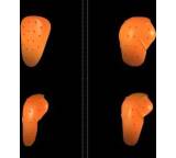 MTB Protektor im Test: T5-Set von D3O, Testberichte.de-Note: 4.9 Mangelhaft