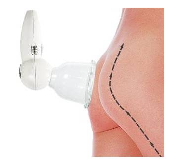 Produktbild Prorelax Vakuum Massagegerät